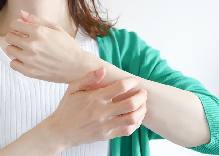 原因不明の蕁麻疹や皮膚の赤み