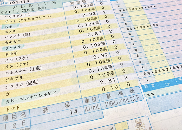 アレルギーを調べるための検査方法