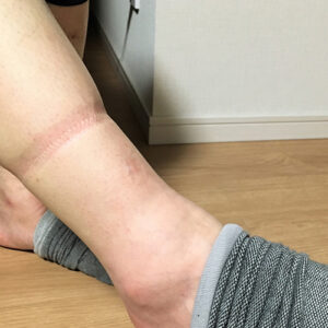 さつまいもは「むくみ」に効く？驚きのカリウム効果で翌朝スッキリ脚を目指す方法